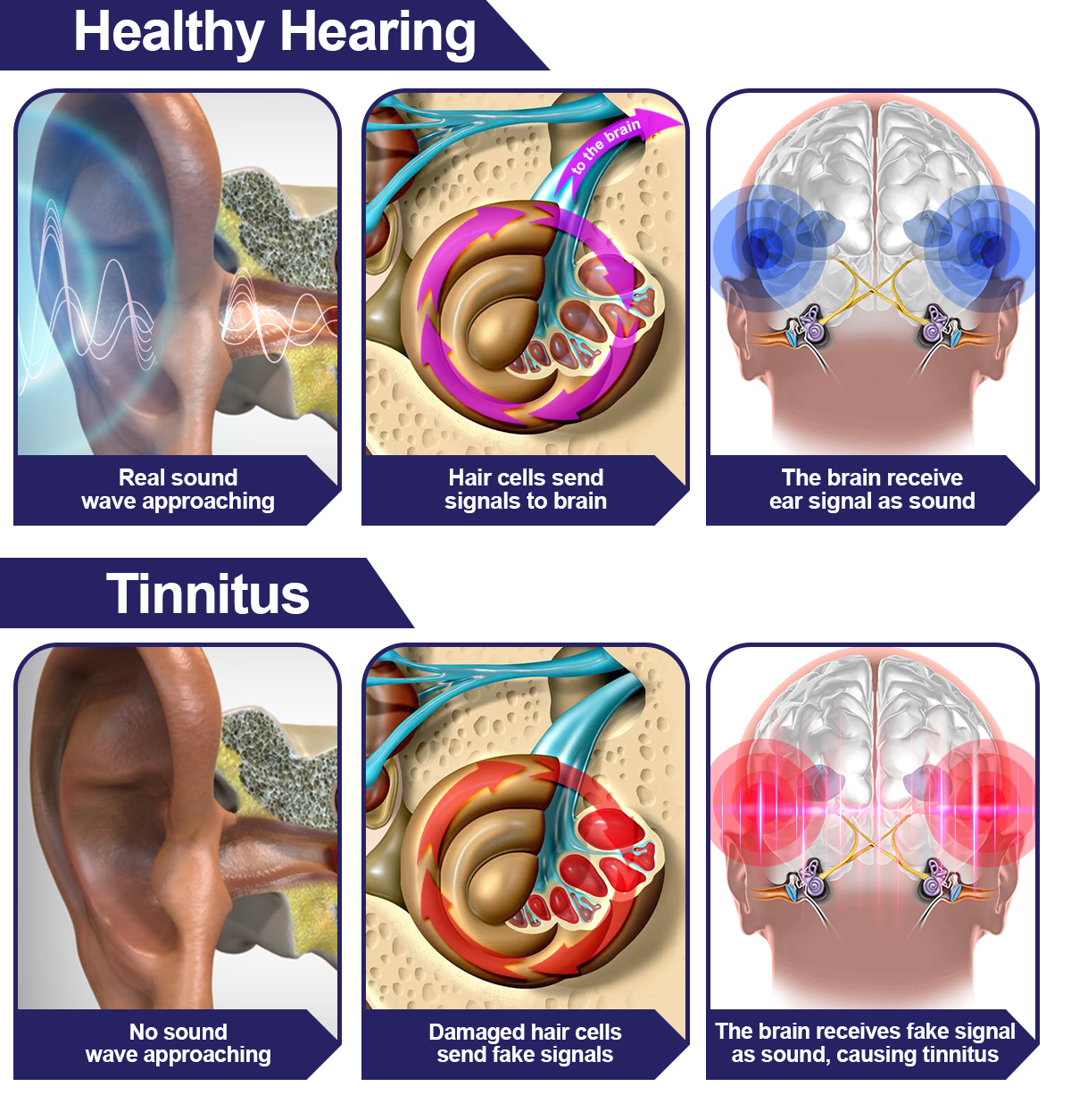 DAFEILA™ INFRAPEACE -Red Light Therapy Ear Plugs 🎵